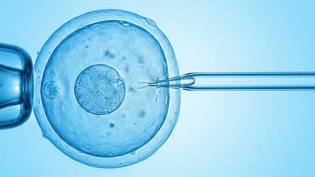 ivf1