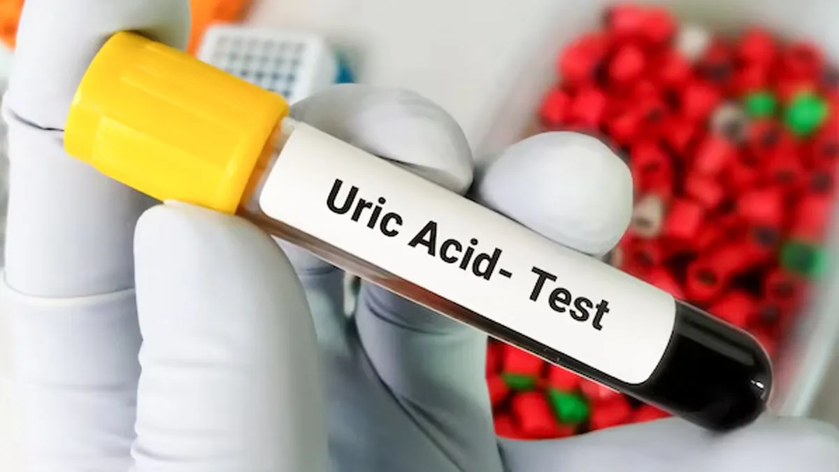 plant uric 1