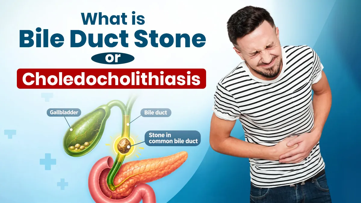 Bile Duct Stones: When a Gallstone Blocks the Bile Duct