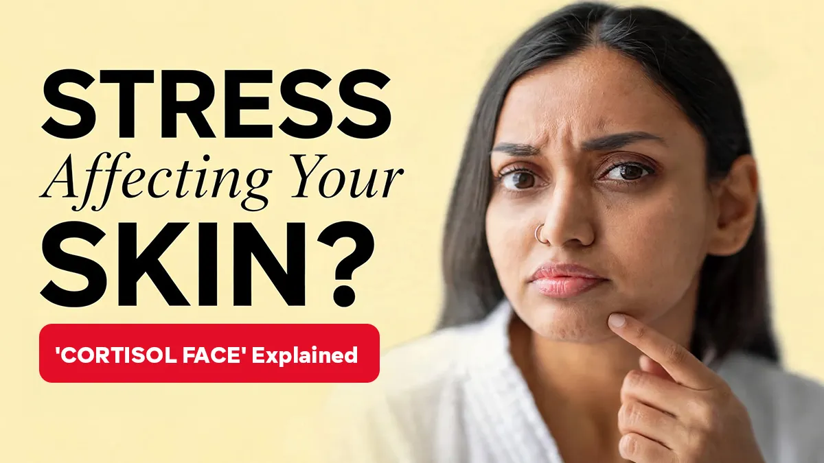 What Is a Cortisol Face? Dermatologist Explains All You Need To Know