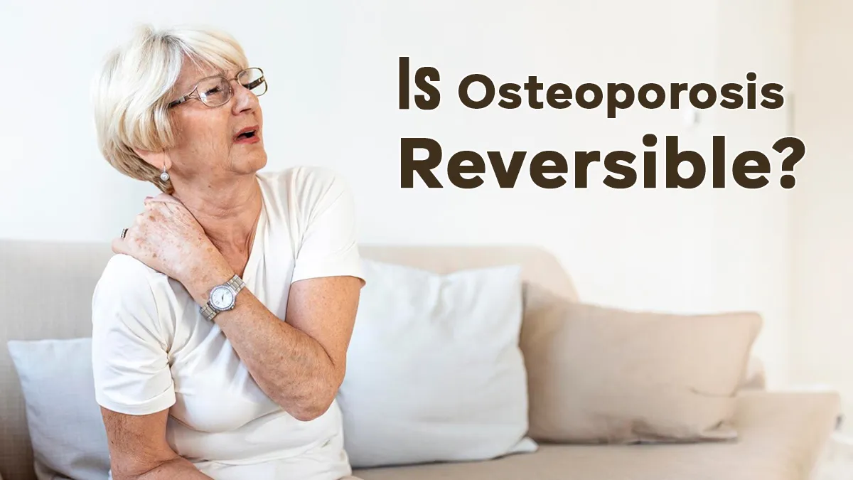 World Osteoporosis Day: Can Osteoporosis Be Reversed? What You Need to Know About Bone Loss