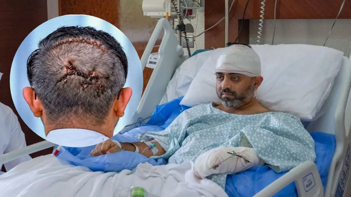 Captain Smit Machchhar’s Head Injury: Doctor Explains the Difference Between Staples and Stitches