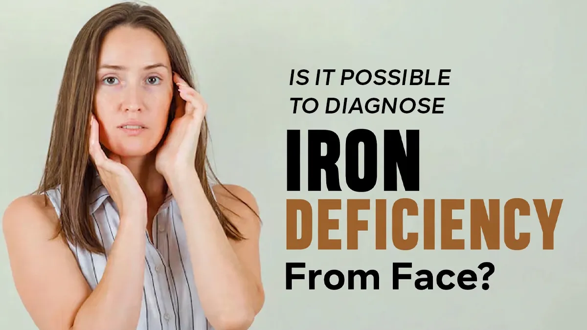 Doctor's Take on Ferritin Face Viral Trend of Identifying Iron Deficiency Just By Looking at Someone's Face: Safety and Risks Explained