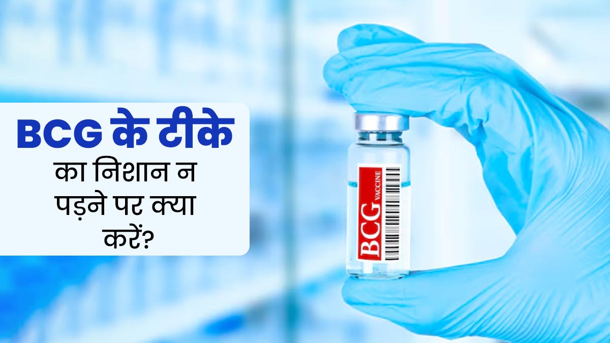 शिशु को BCG का टीका लगवाने के बाद निशान न पड़े, तो क्या दोबारा टीका लगवाना चाहिए? जानें डॉक्टर की सलाह