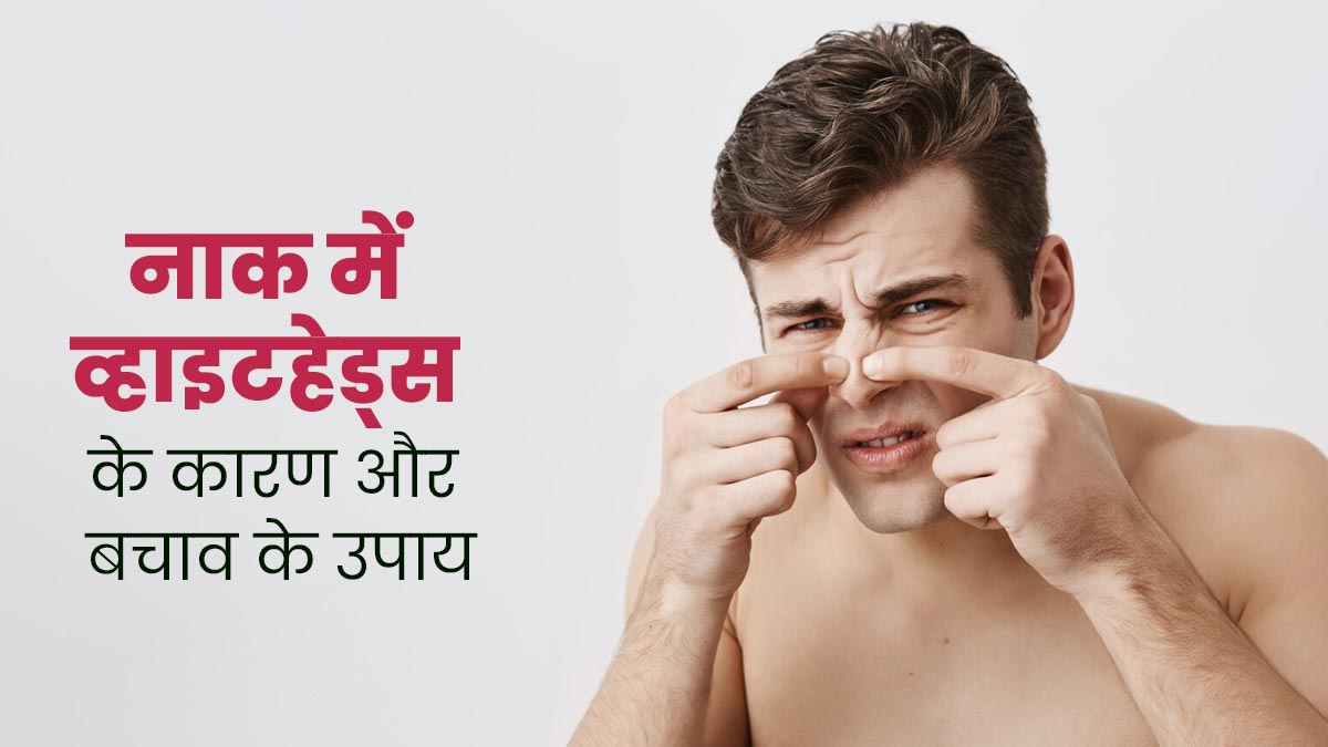नाक पर व्हाइटहेड्स क्यों होते हैं? जानें कारण और बचाव के तरीके