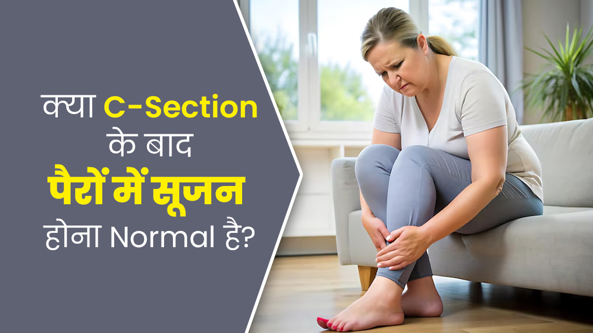 क्या सिजेरियन डिलीवरी के बाद पैरों में सूजन बढ़ना सामान्य है? जानें डॉक्टर की राय
