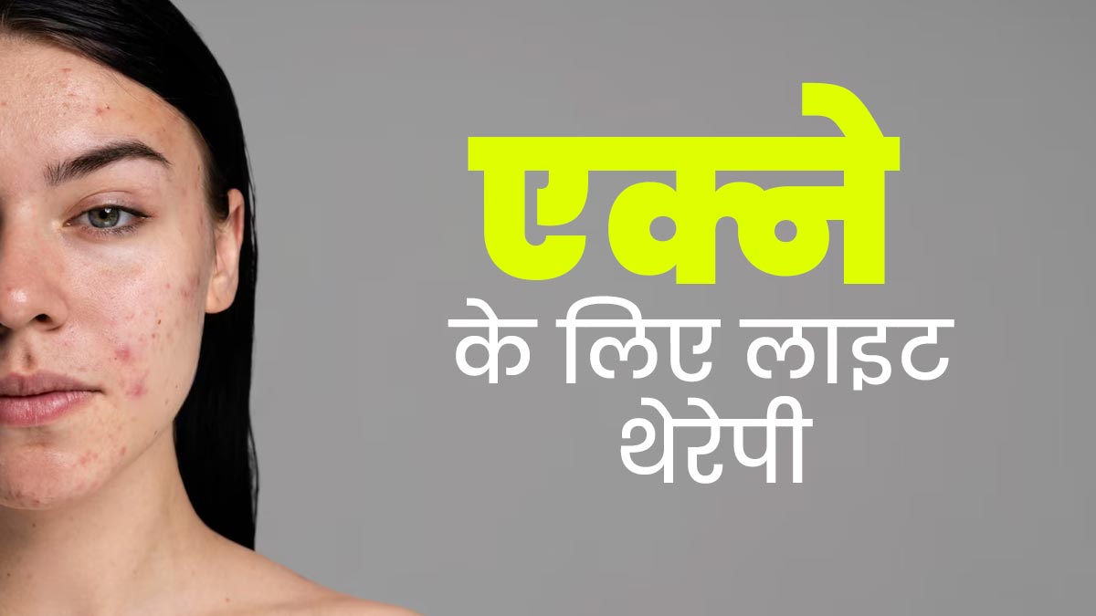 लाइट थेरेपी से कम हो सकते हैं चेहरे के कील-मुंहासे, डॉक्टर से जानें इसके फायदे और सावधानियां
