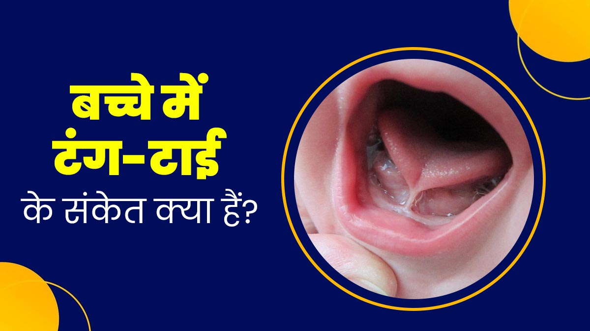 ये संकेत बताते हैं कि बच्चे को है टंग-टाई (जीभ चिपकी होने) की समस्या, डॉक्टर से जानें क्या करें और क्या नहीं