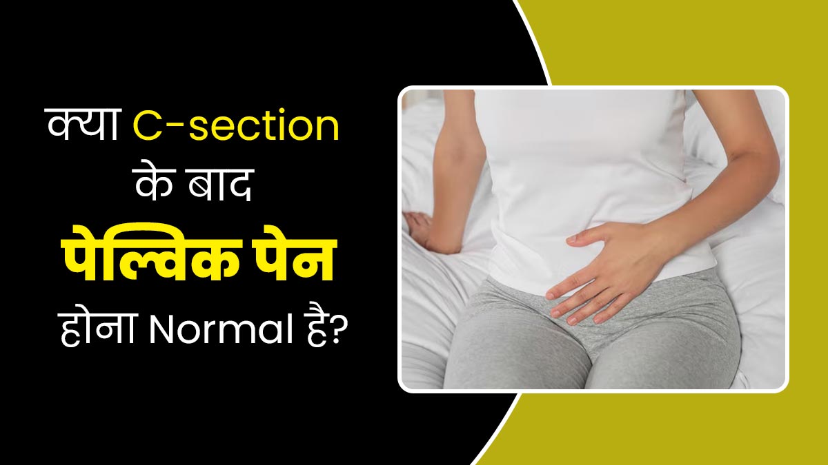 C-Section के बाद कई महिलाओं को होता है पेल्विक पेन, जानें ऐसा होना सामान्य है या नहीं?