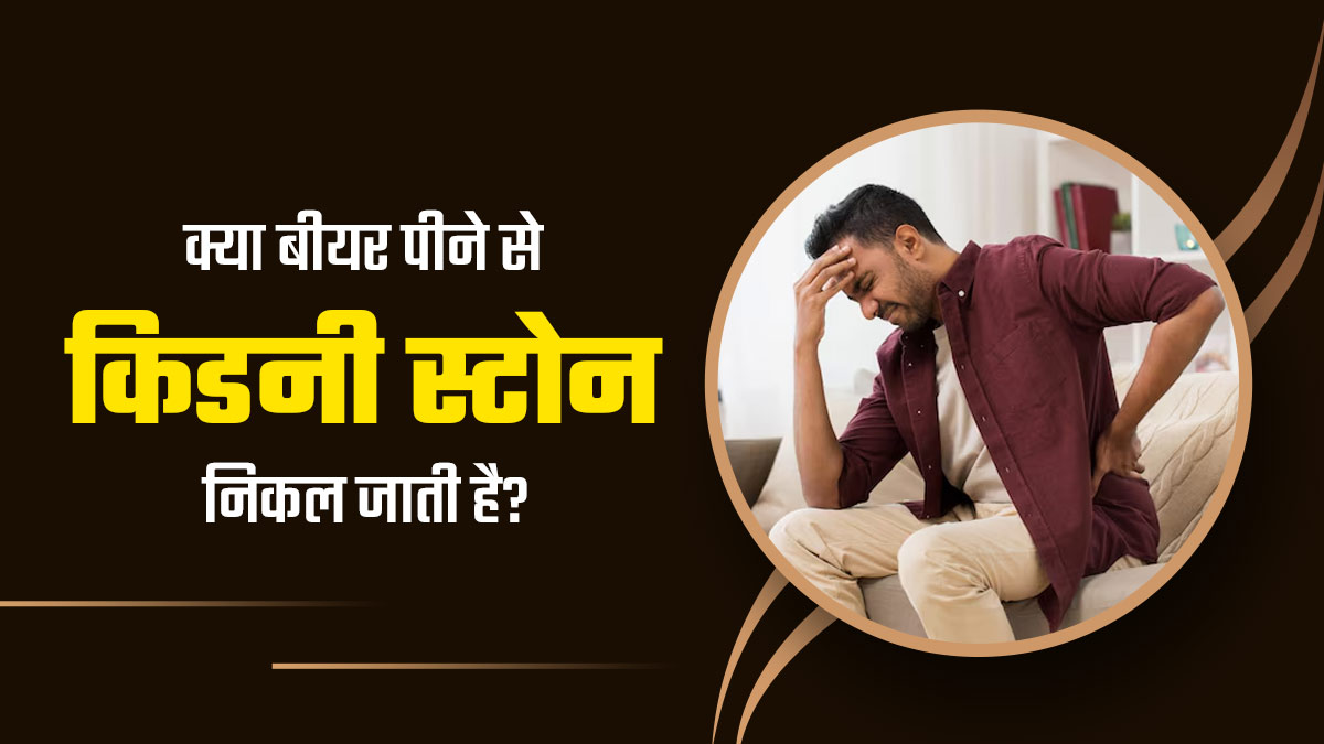 क्या वाकई बीयर पीने से किडनी स्टोन निकल जाती है? जानें डॉक्टर से