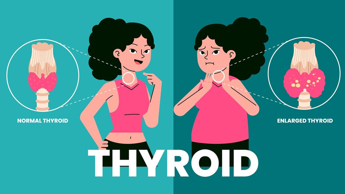 Reasons for being constipated