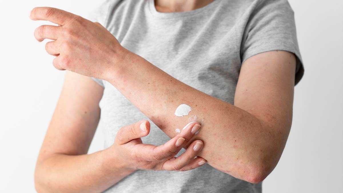 inside-burning-first-aid