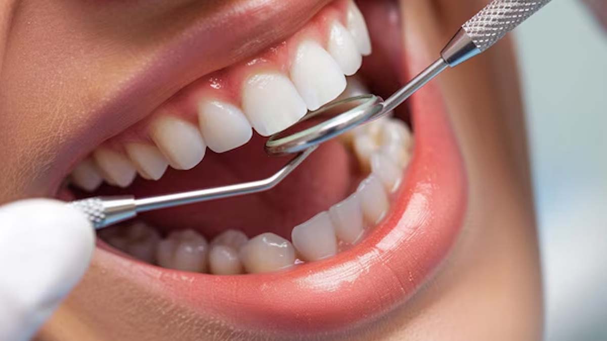 inside-yellow-teeth-remedy