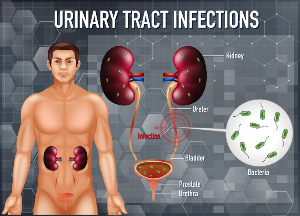 urinary-tract-infection