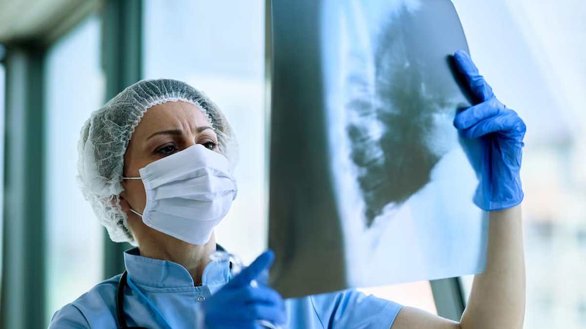 how-to-get-rid-of-mucus-in-lungs-1
