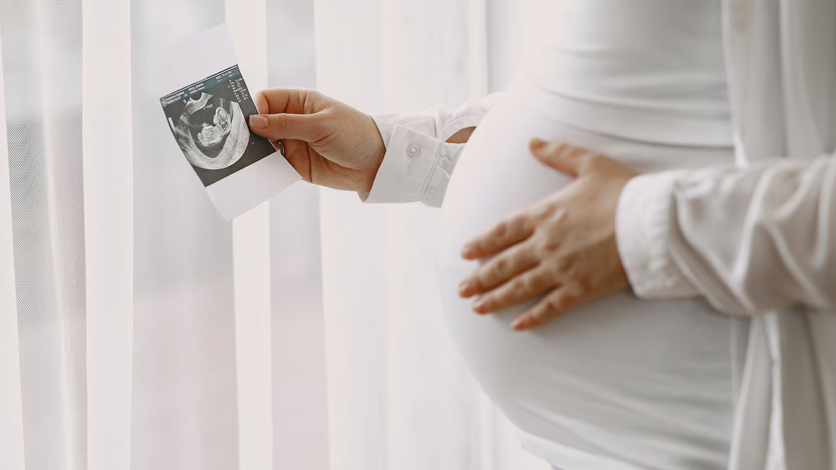 Pregnant Women