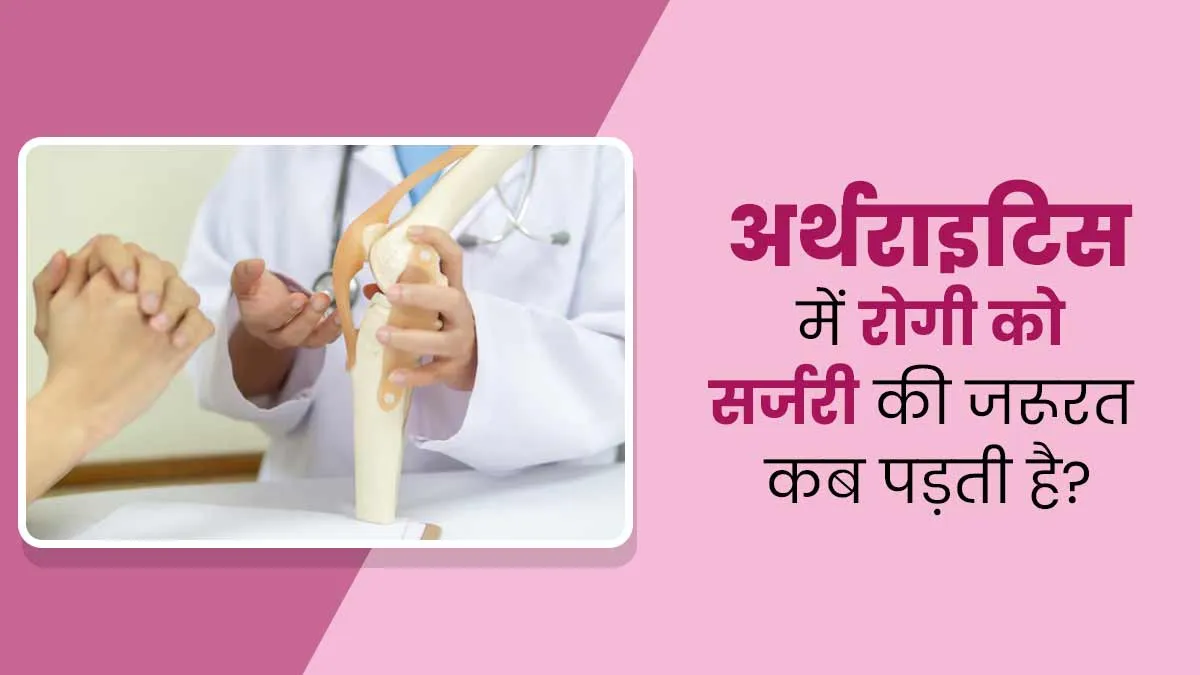 गठिया के रोगियों को सर्जरी की जरूरत कब पड़ती है? डॉक्टर से जानें