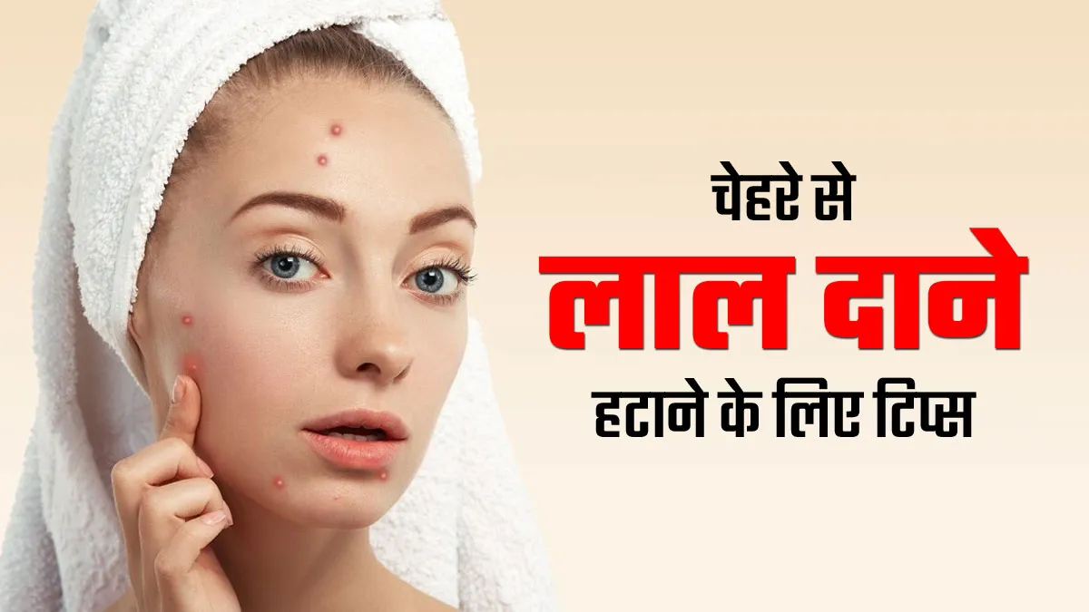 चेहरे के लाल दाने कैसे हटाएं? अपनाएं ये 5 टिप्स और घरेलू उपाय