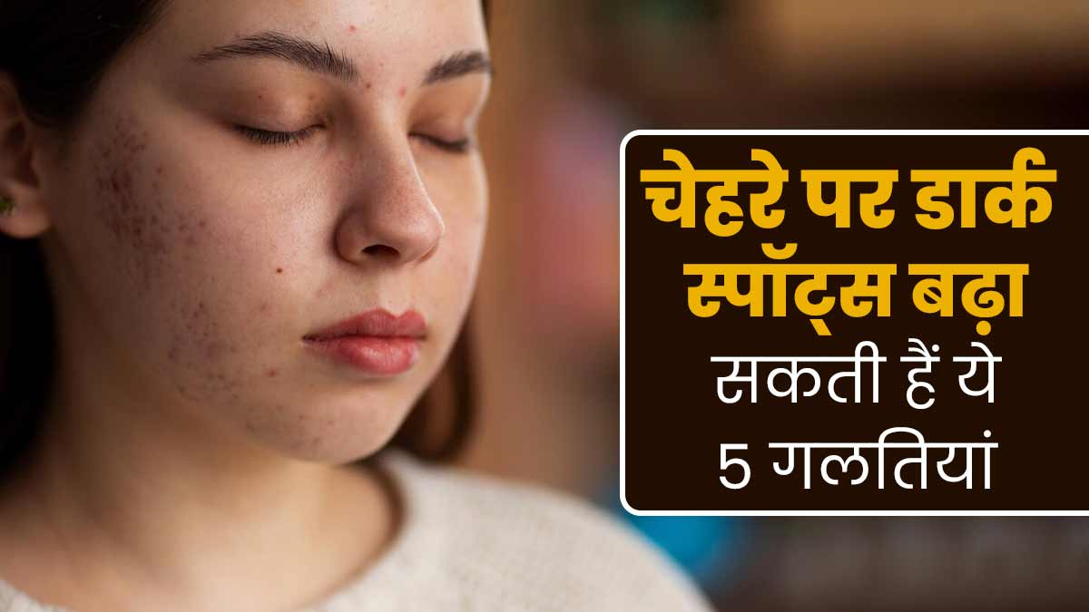 चेहरे पर डार्क स्पॉट्स बढ़ा सकती हैं ये 5 गलतियां, डॉक्टर से जानें बचाव के उपाय