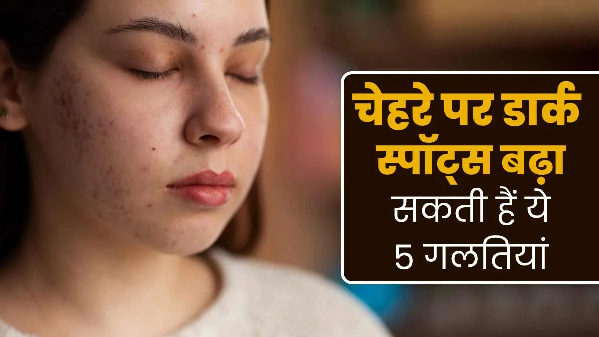 चेहरे पर डार्क स्पॉट्स बढ़ा सकती हैं ये 5 गलतियां, डॉक्टर से जानें बचाव के उपाय