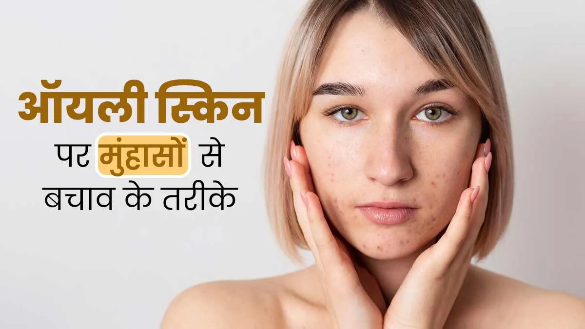 ऑयली स्किन पर क्यों होते हैं बार-बार मुंहासे? जानें बचाव और उपचार के तरीके