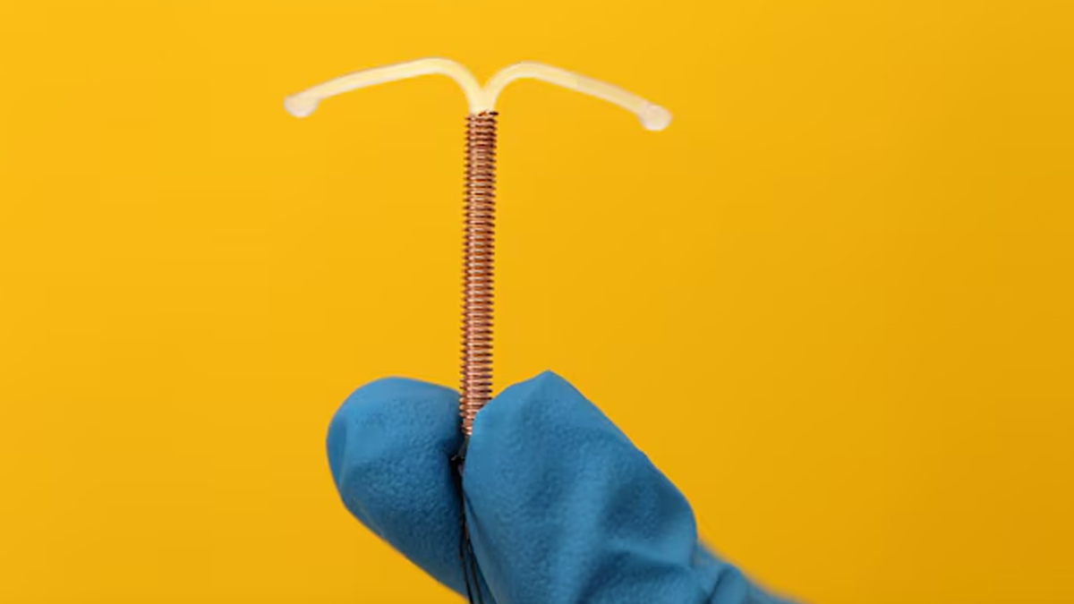 how-long-should-you-wait-to-conceive after-iud-2