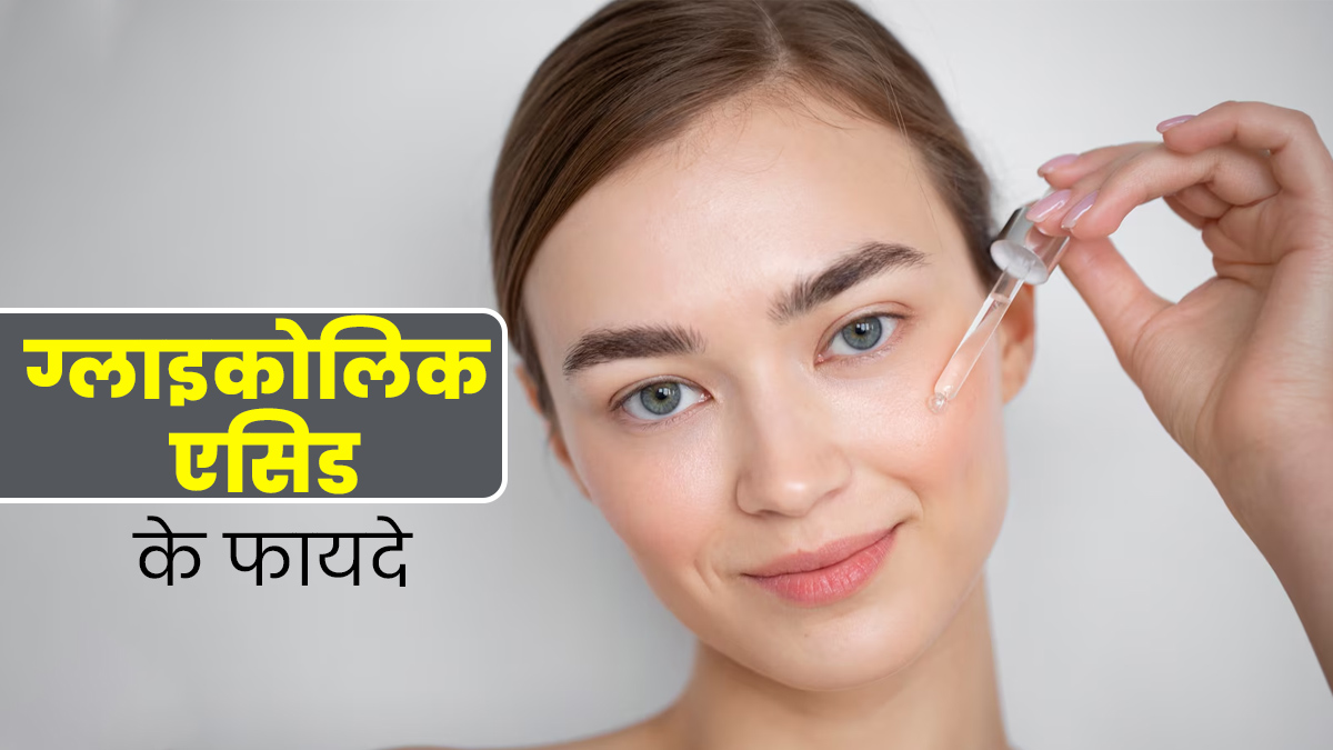 मुंहासों की समस्या दूर करता है ग्लाइकोलिक एसिड, जानें त्वचा पर कैसे करता है काम