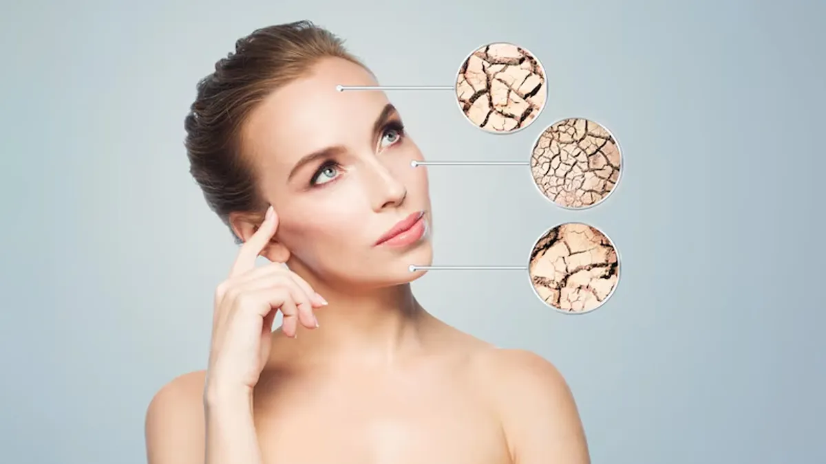 चेहरे पर नजर आ रहे हैं ड्राई पैचेज? जानें इस समस्‍या के 5 कारण, लक्षण और इलाज