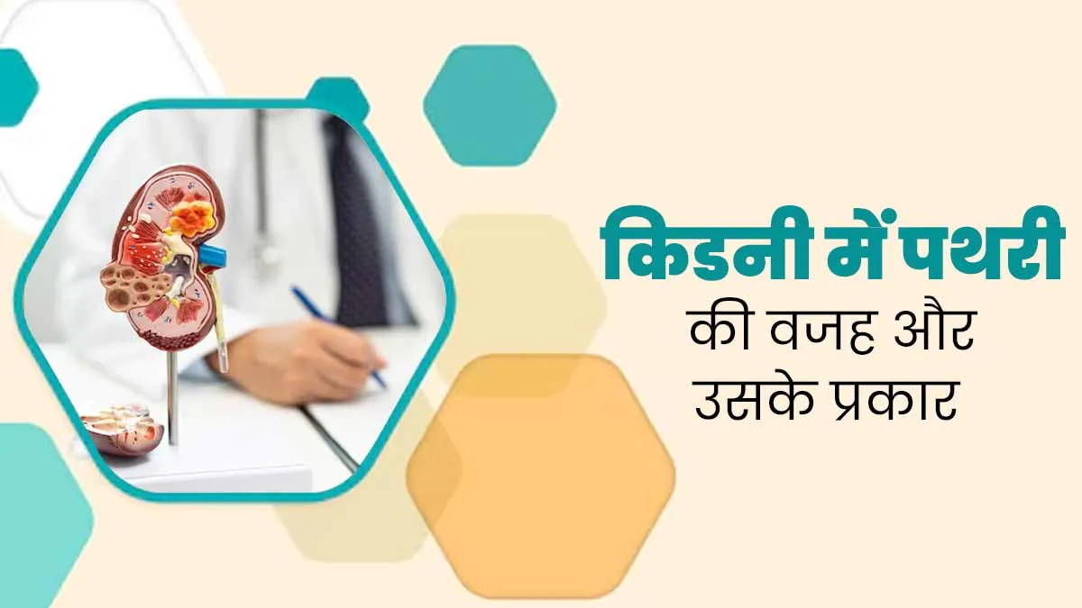 किडनी में पथरी होने की क्या है वजह? एक्सपर्ट से जानें कितनी तरह की हो सकती है किडनी की पथरी