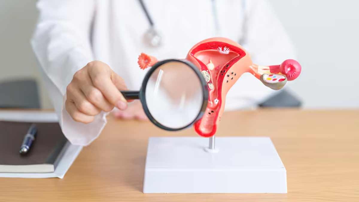 inside-pcos-and-trauma