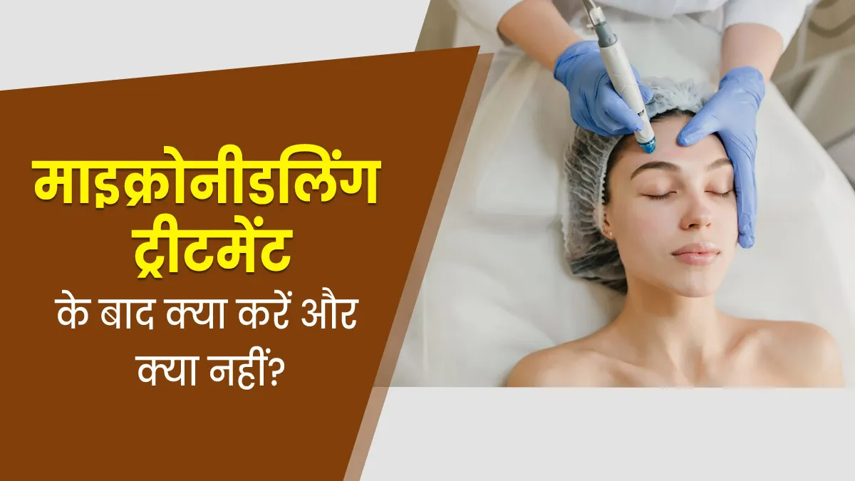 त्वचा पर कोलेजन बढ़ाने में असरदार है माइक्रोनीडलिंग ट्रीटमेंट, जानें इसे लेने के बाद क्या करें और क्या नहीं?