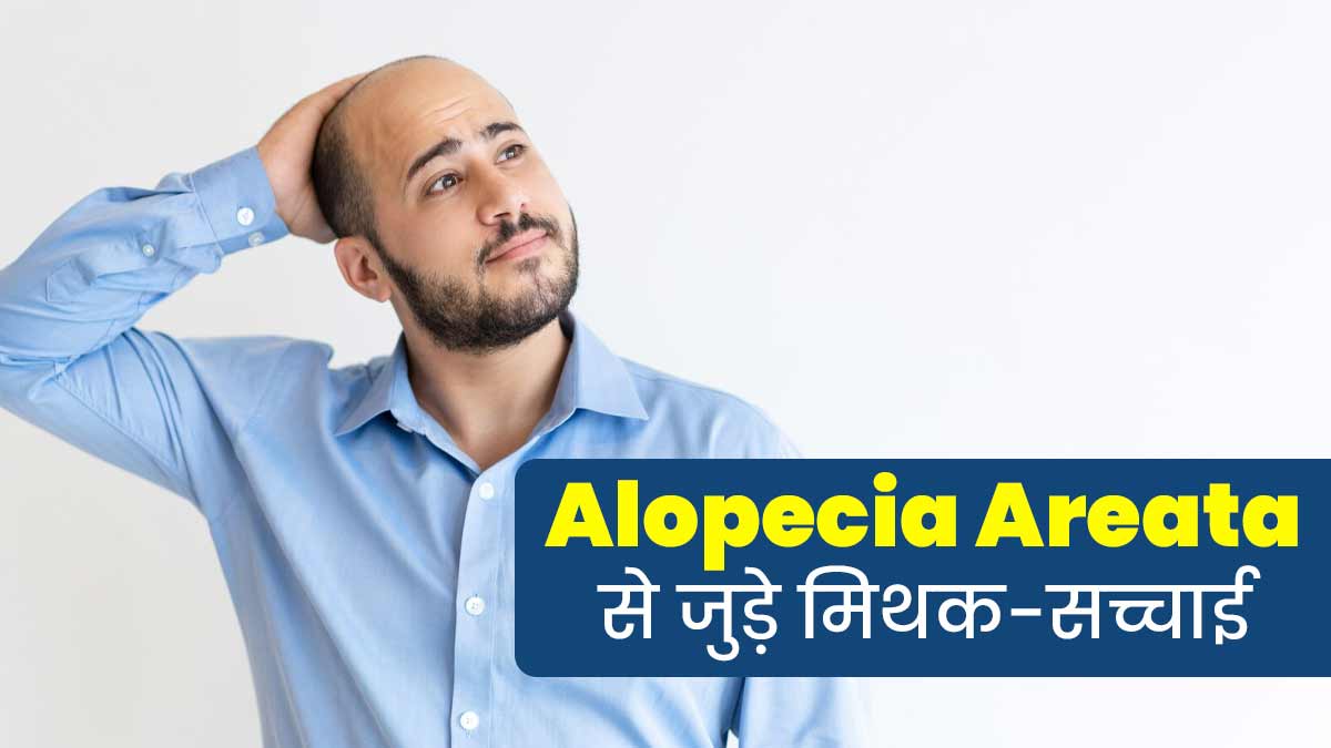 एलोपेसिया एरीटा से जुड़ी इन 5 भ्रामक बातों पर लोग करते हैं यकीन, एक्सपर्ट से जानें इनकी सच्चाई
