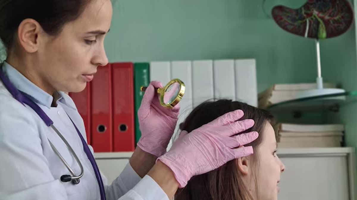 Does-Lupus-cause-scalp-related-issues-02