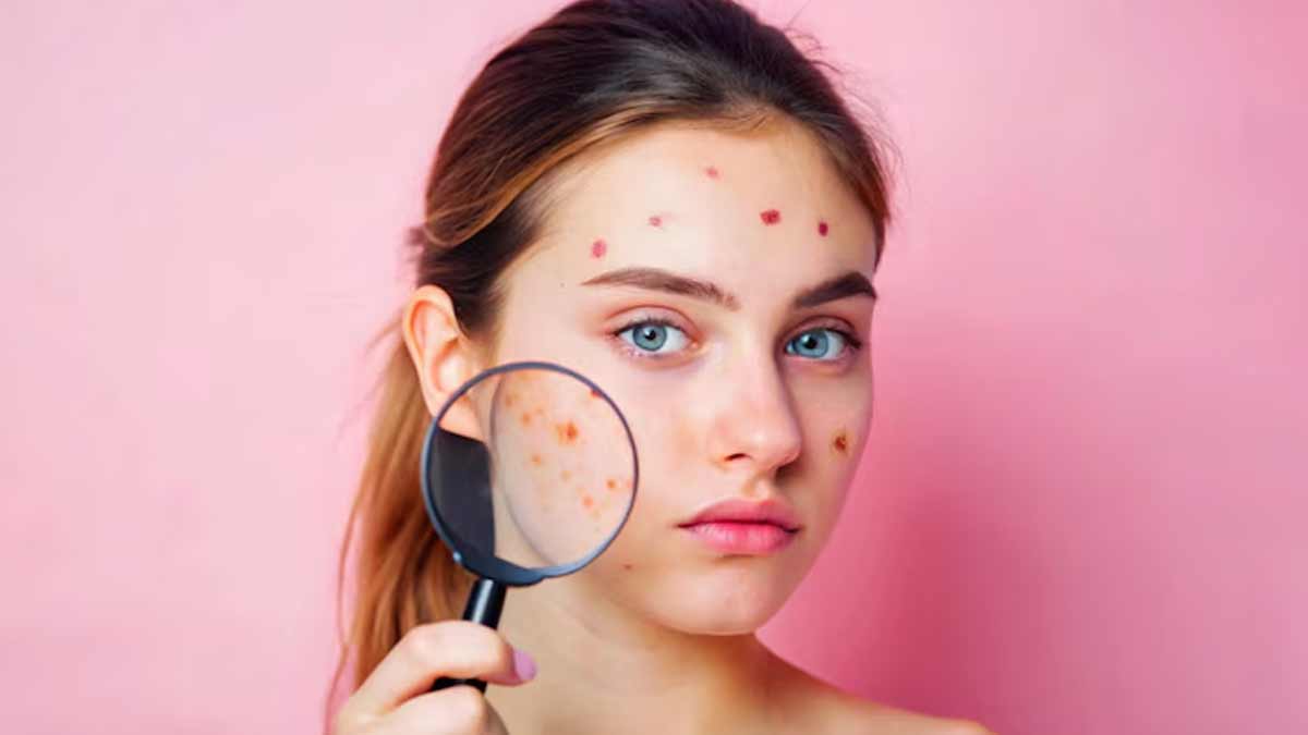 skin-care-tips-during-air-pollution