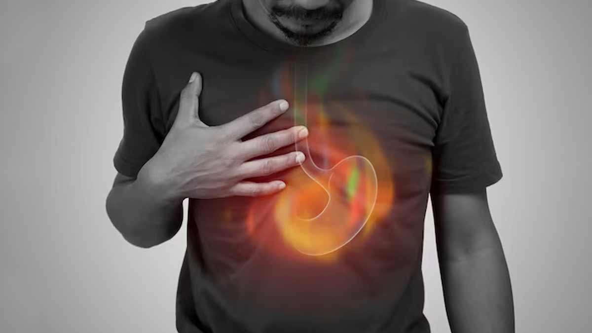 Silent Reflux Symptoms And Causes silent-reflux-symptoms-causes-in