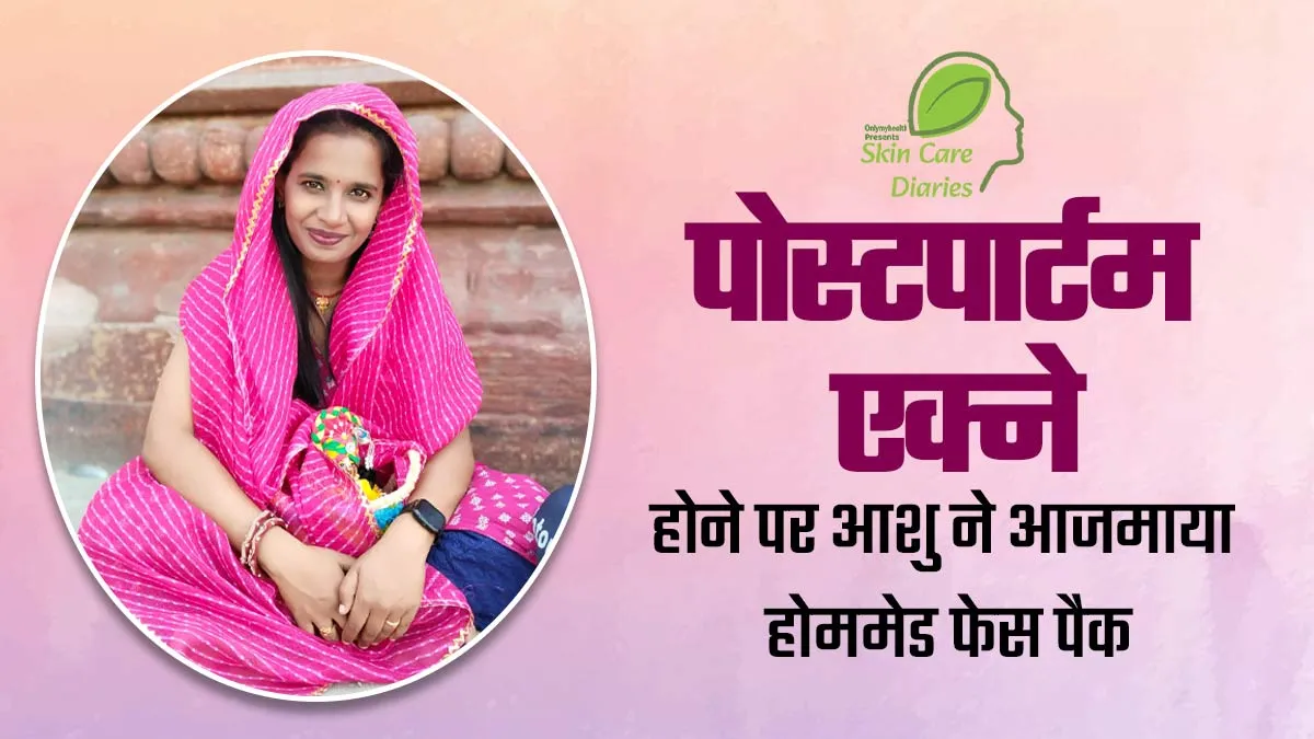 डिलीवरी बाद आशु को हुई थी चेहरे पर एक्ने की समस्या, चावल के फेस पैक से पाई निखरी त्वचा