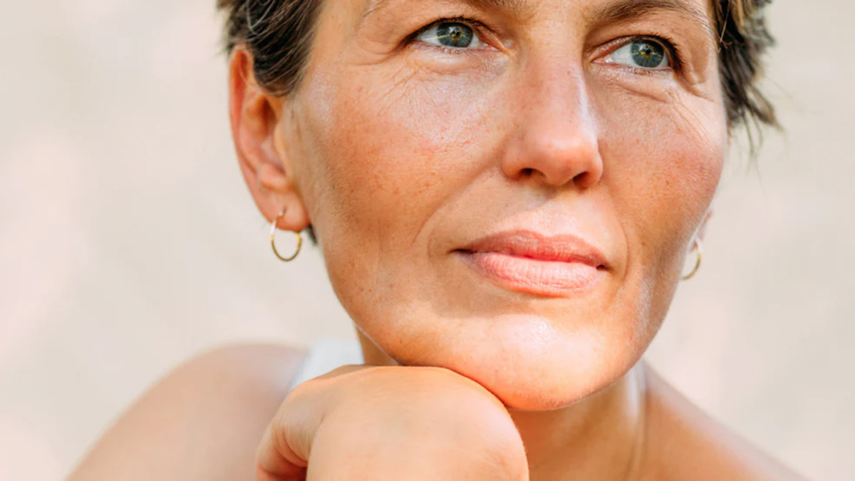 freckles-during-menopause