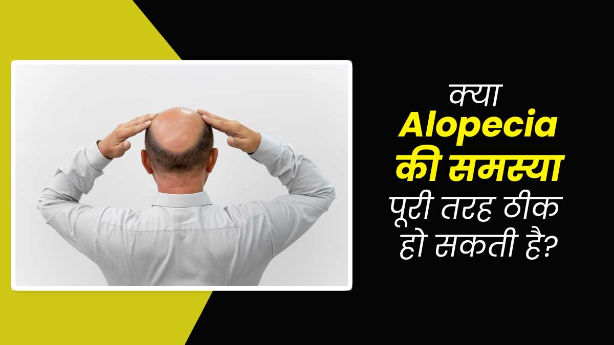 बाल झड़ने की बीमारी है एलोपेसिया, क्या यह पूरी तरह ठीक हो सकती है? जानें एक्सपर्ट से
