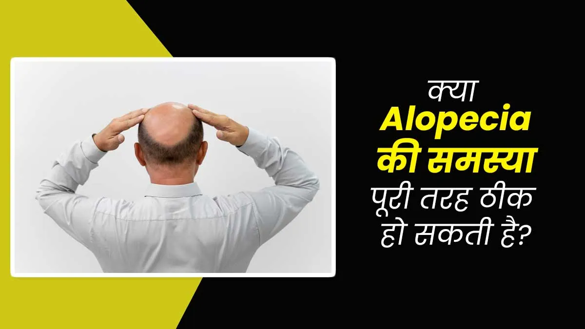 बाल झड़ने की बीमारी है एलोपेसिया, क्या यह पूरी तरह ठीक हो सकती है? जानें एक्सपर्ट से