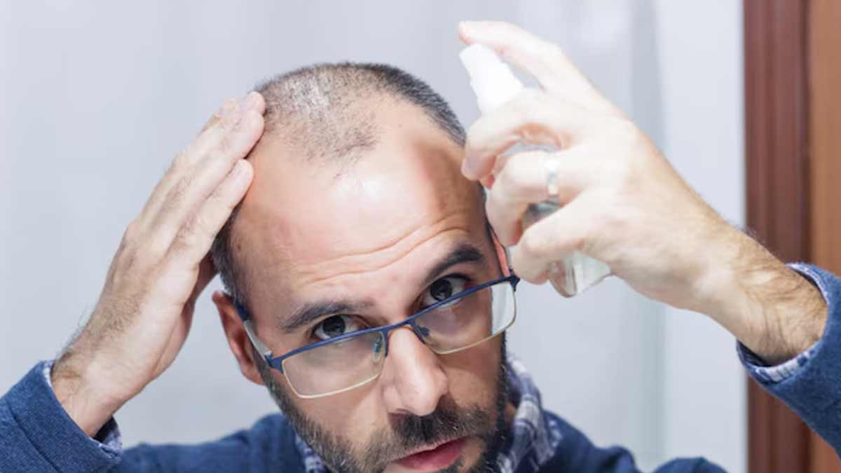 is-it-safe-to-dye-hair-with-alopecia-01