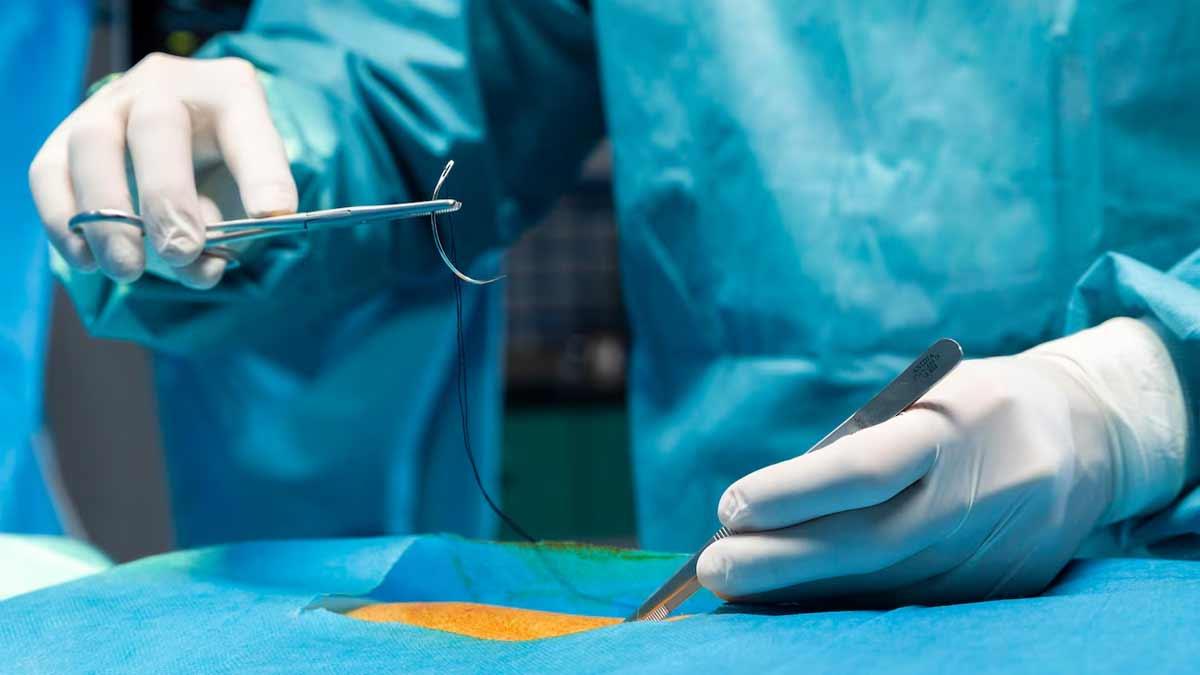 side-effects-of-prostate-surgery-01