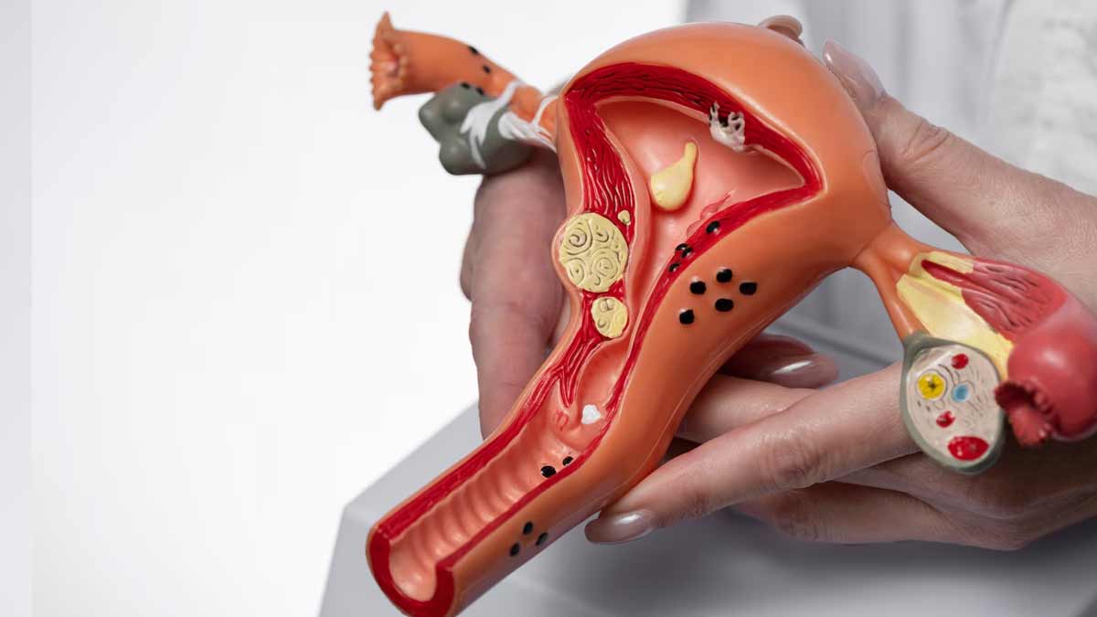 ovarian-cysts-after-menopause-01