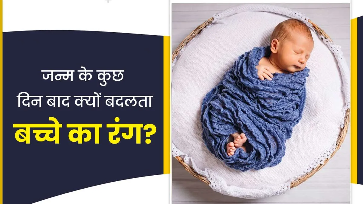 जन्म के कुछ दिन बाद क्यों बदलने लगता है बच्चे का रंग? डॉक्टर से जानें इसके बारे में