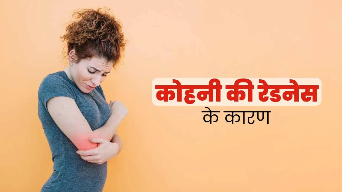 कोहनी की त्‍वचा लाल क्‍यों हो जाती है? डॉक्‍टर से जानें इसका कारण और इलाज