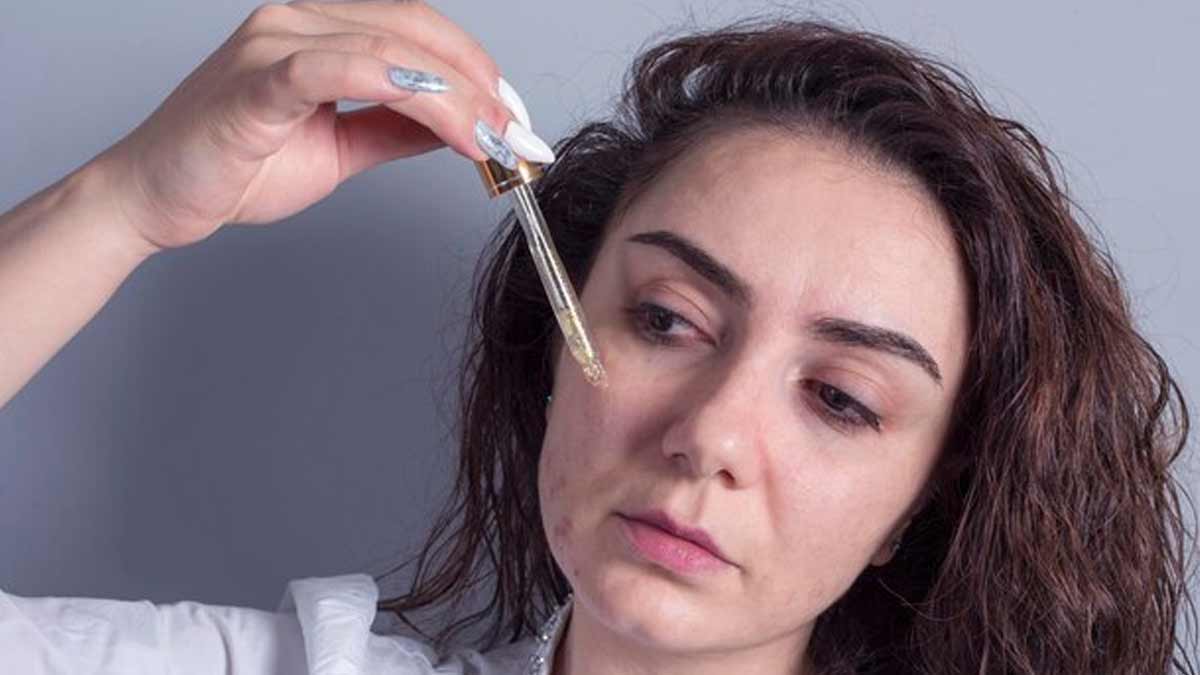 क्‍या पिंपल्स के निशान हटाने के ल‍िए असरदार है सैलिसिलिक एसिड? एक्‍सपर्ट से जानें