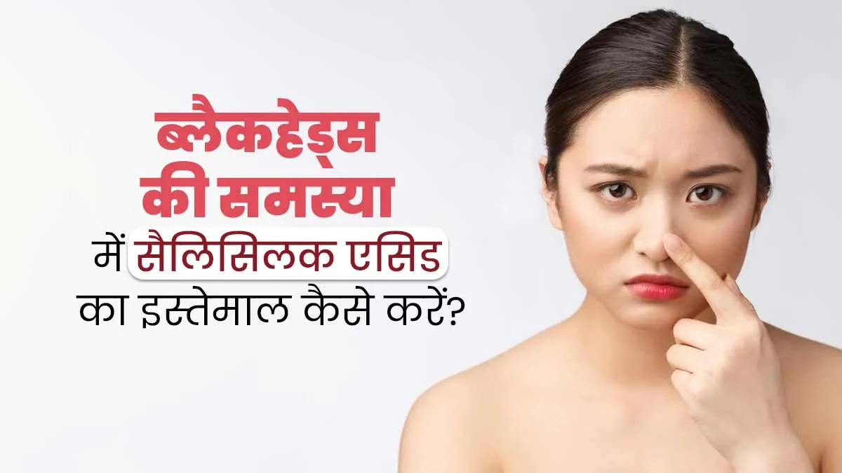 ब्लैकहेड्स की समस्या को दूर कर सकता है सैलिसिलिक एसिड, जानें इस्तेमाल का तरीका