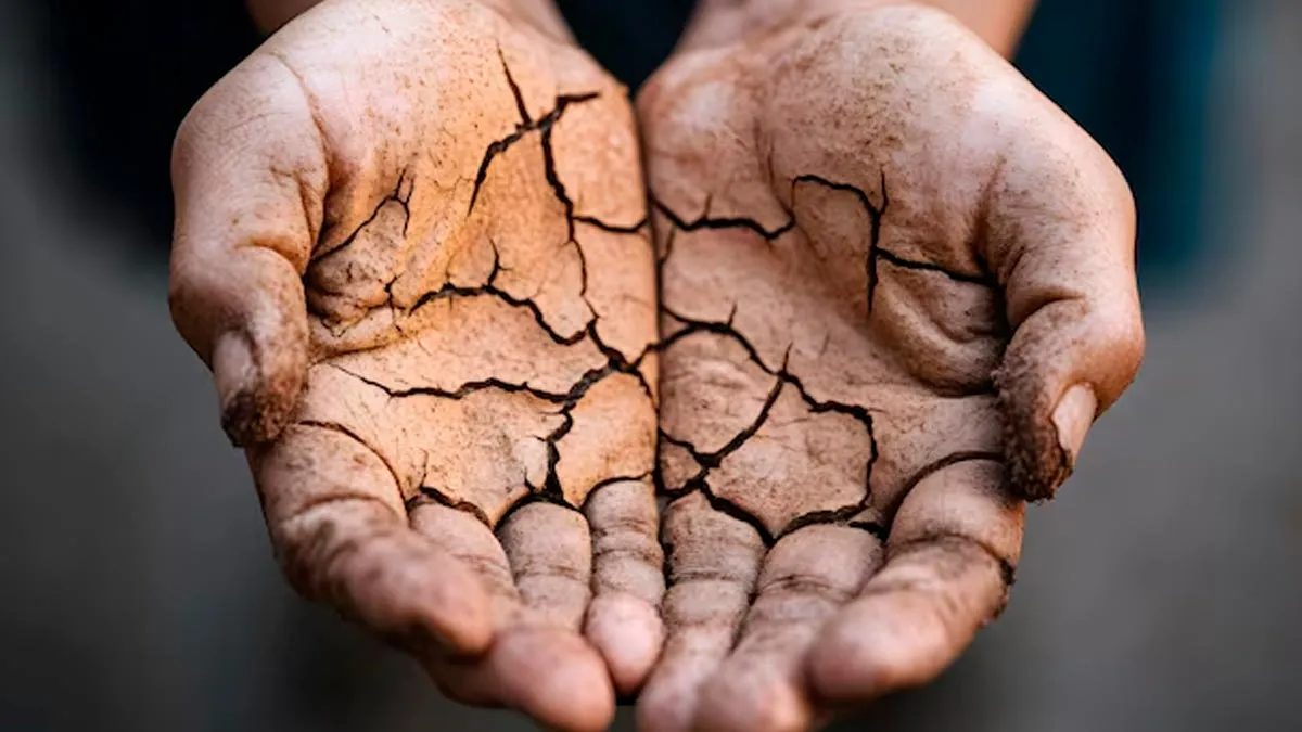 सर्दियों में बरकरार रहेगी हाथों की नमी और नहीं फटेगी त्‍वचा, बस फॉलो करें ये 7 स्‍क‍िन केयर ट‍िप्‍स