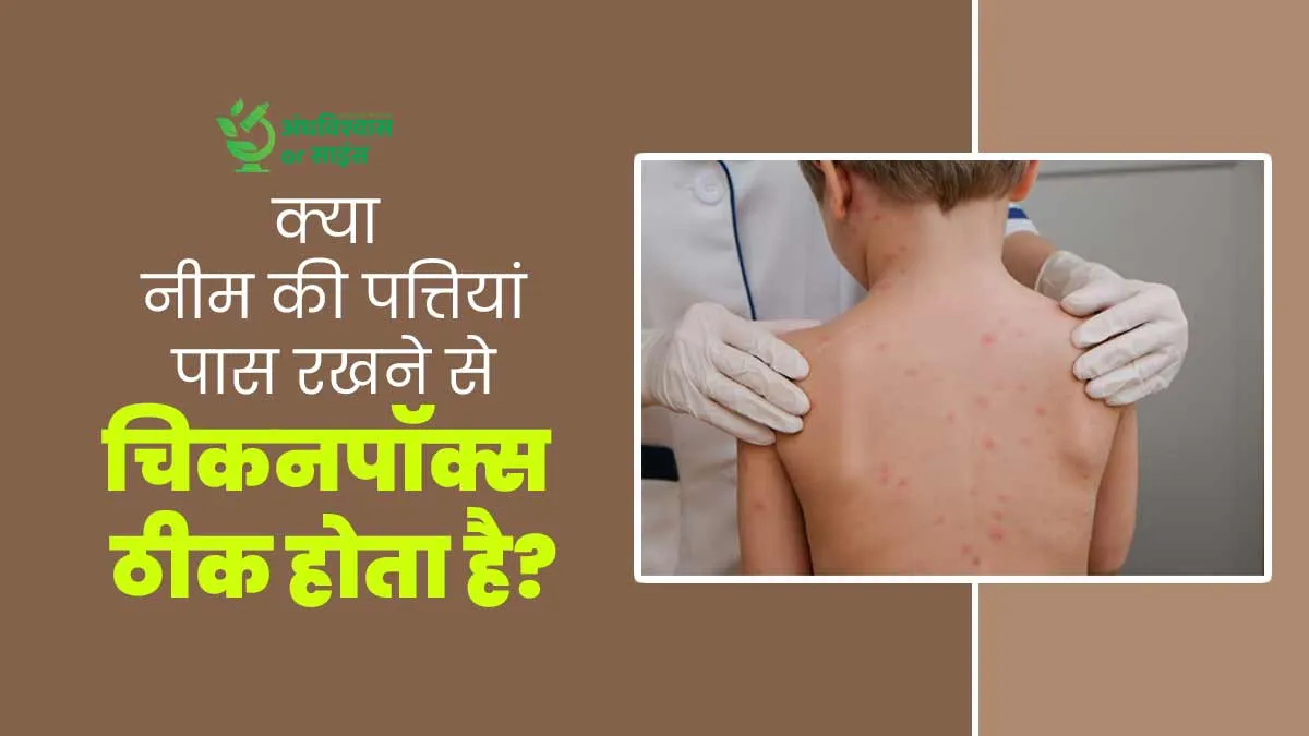 क्या सच में चिकनपॉक्स (छोटी माता) होने पर आसपास नीम की पत्तियां रखने से आराम मिलता है? जानें डॉक्टर से