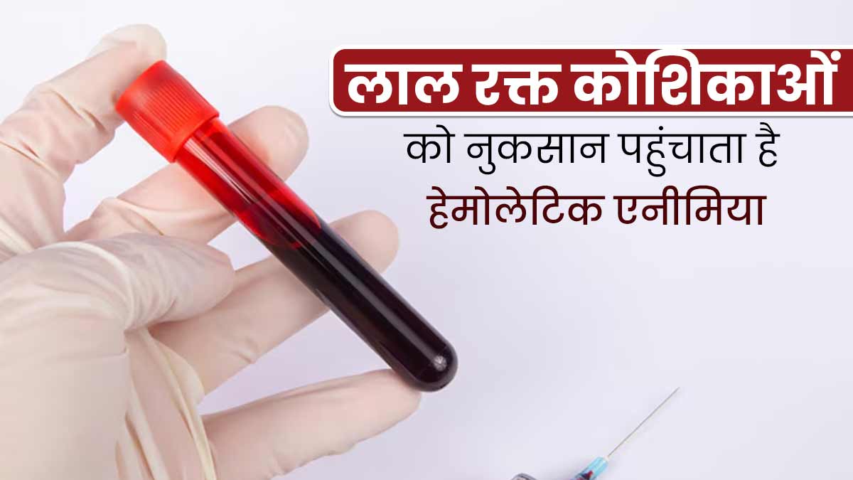 लाल रक्त कोशिकाओं को नुकसान पहुंचाता है हेमोलेटिक एनीमिया, जानें इसके लक्षण