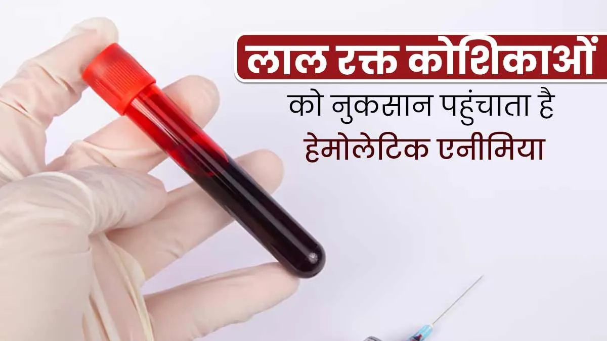 लाल रक्त कोशिकाओं को नुकसान पहुंचाता है हेमोलेटिक एनीमिया, जानें इसके लक्षण